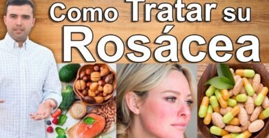 ¿Cómo eliminar piel sensible en la cara?