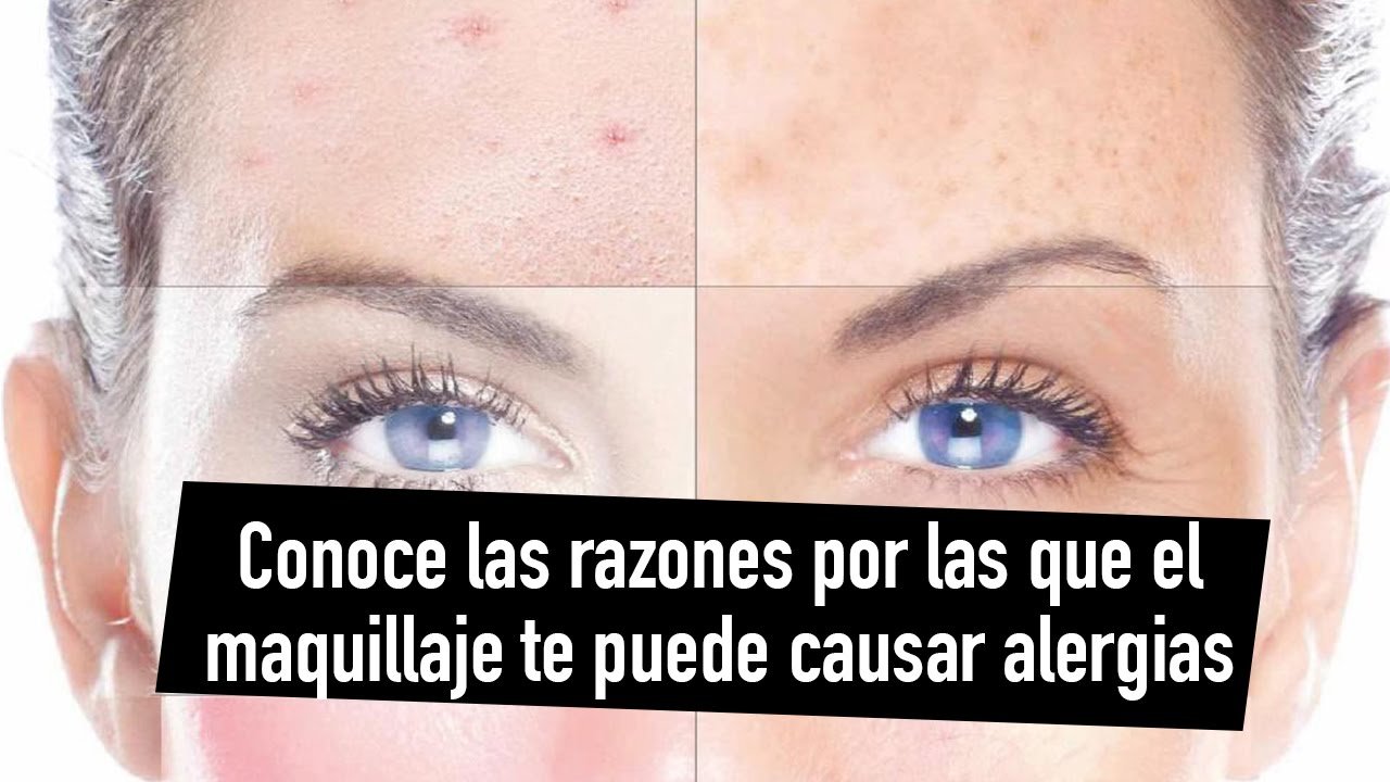 ¿Cómo se llama el maquillaje que no da alergia?