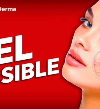 ¿Cómo se ven las pieles sensibles?