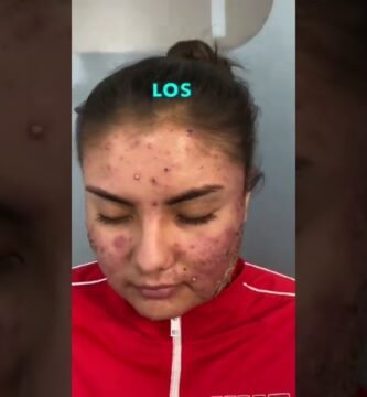 consejos de dermatólogos sobre maquillaje para zona t reactiva