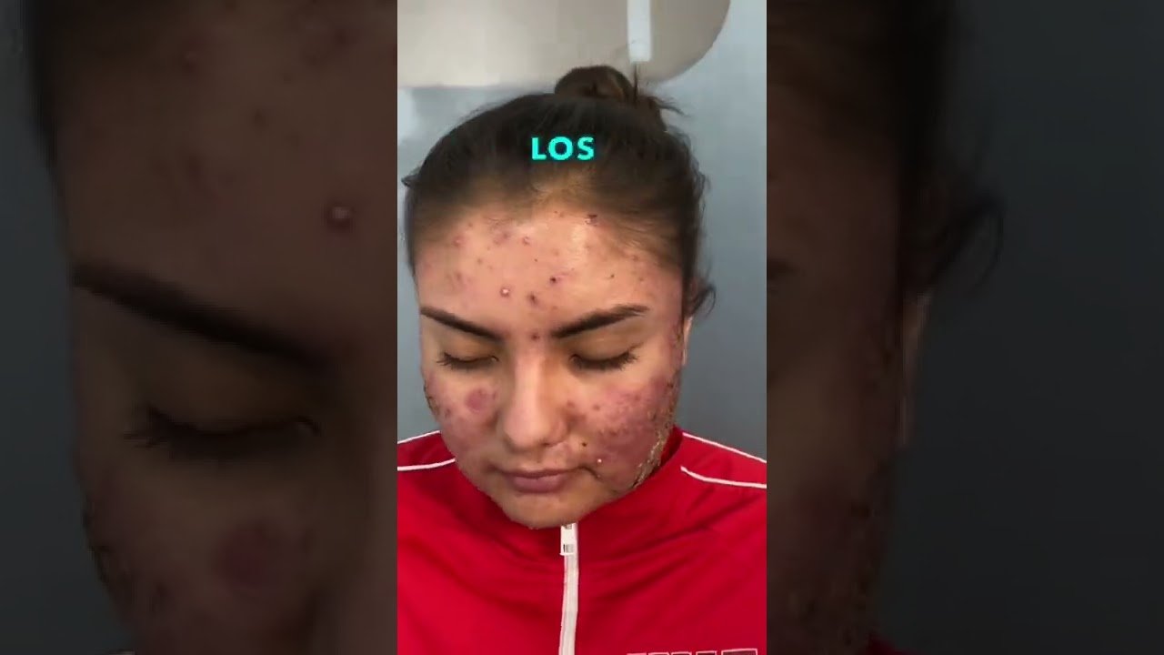 consejos de dermatólogos sobre maquillaje para zona t reactiva