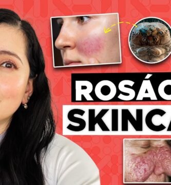 cuidados previos al maquillaje para rostro con enrojecimiento