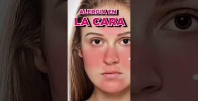 cómo evitar irritaciones con maquillaje para mejillas irritadas