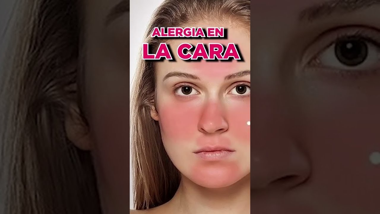 cómo evitar irritaciones con maquillaje para mejillas irritadas