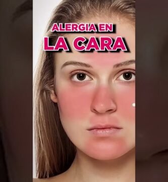 cómo evitar irritaciones con maquillaje para rostro inflamado