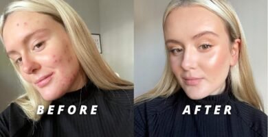 cómo lograr un look natural con maquillaje para piel con acné