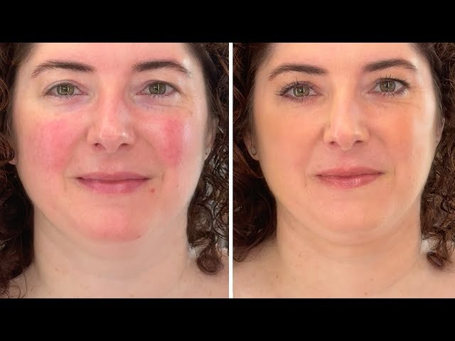 errores comunes en maquillaje para rostro con enrojecimiento