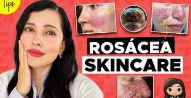 guía completa de maquillaje para piel con rosácea
